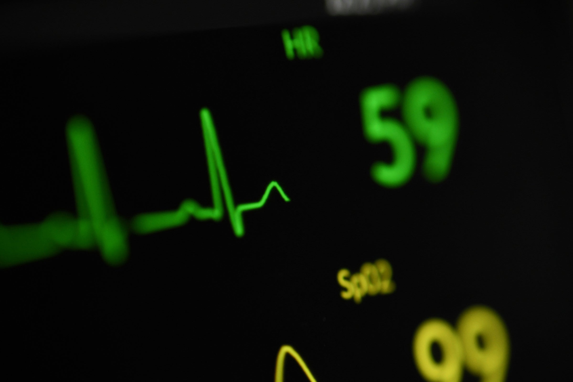 Zone 2 Cycling: Power, Heart Rate and Benefits Explained